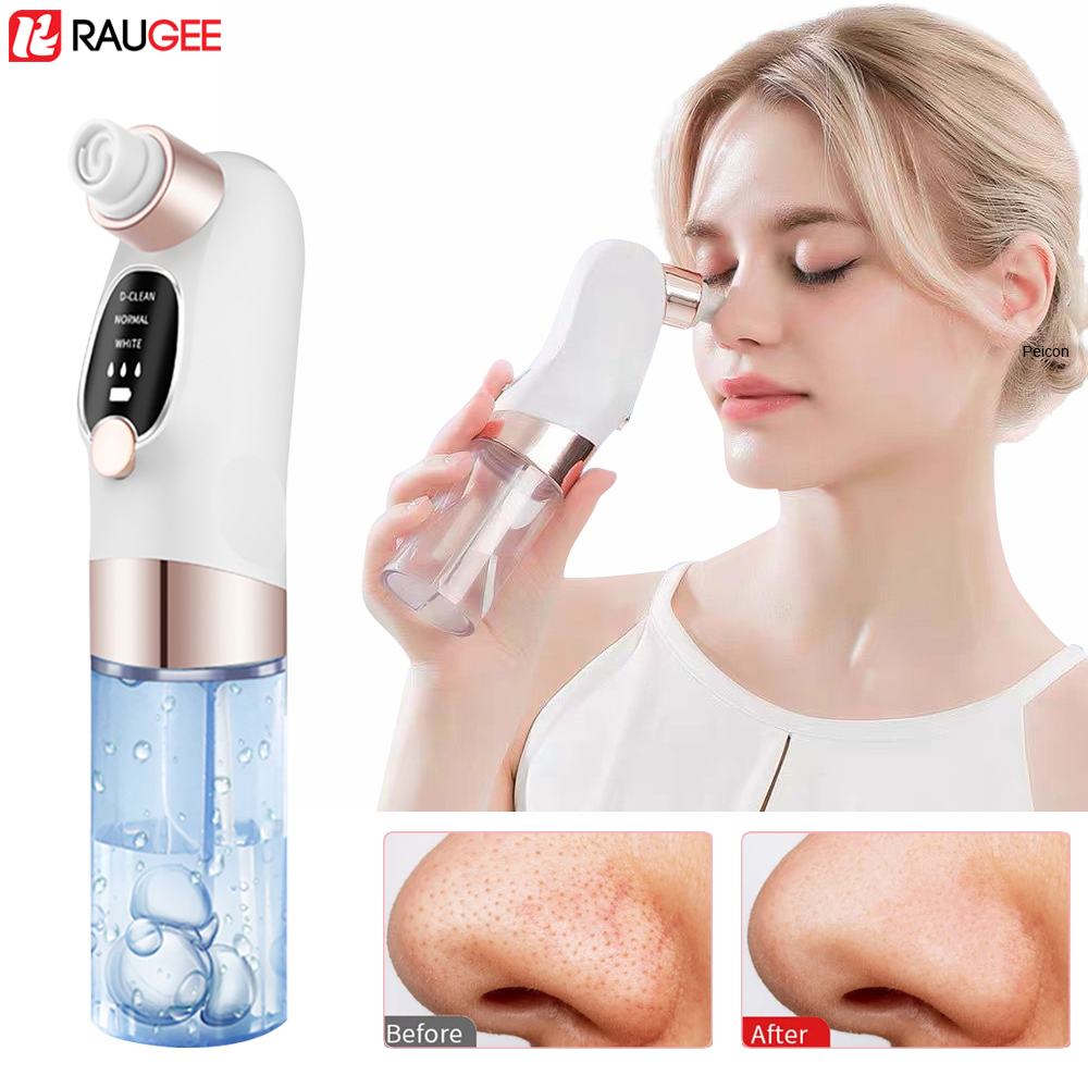 Penghilang komedo elektrik, ek - Air Bubble Remover ulasan dan harga